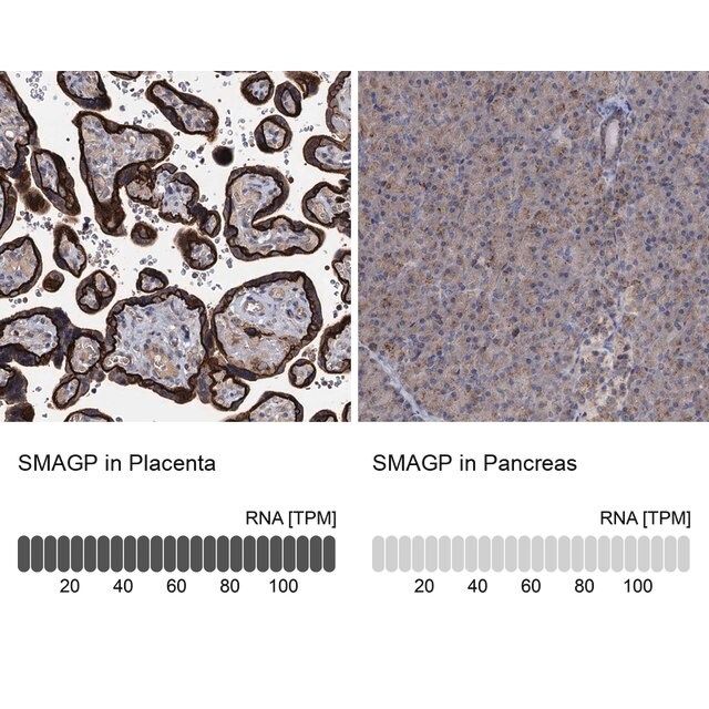 Anti-SMAGP antibody produced in rabbit