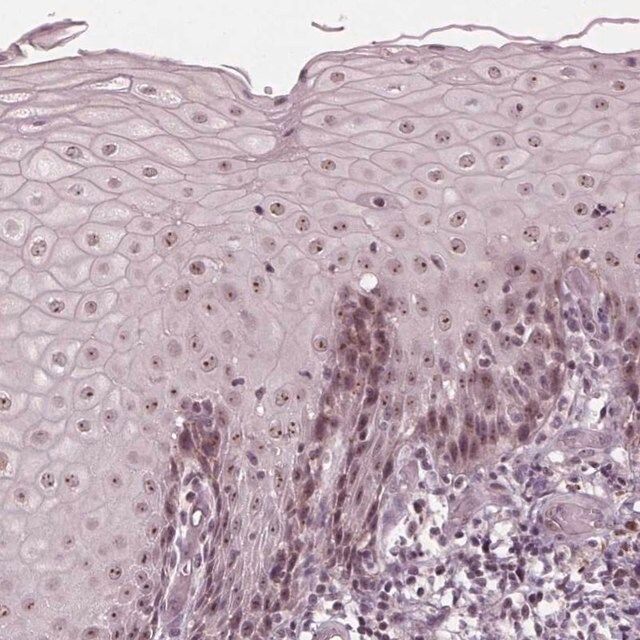 Anti-SLX4 antibody produced in rabbit