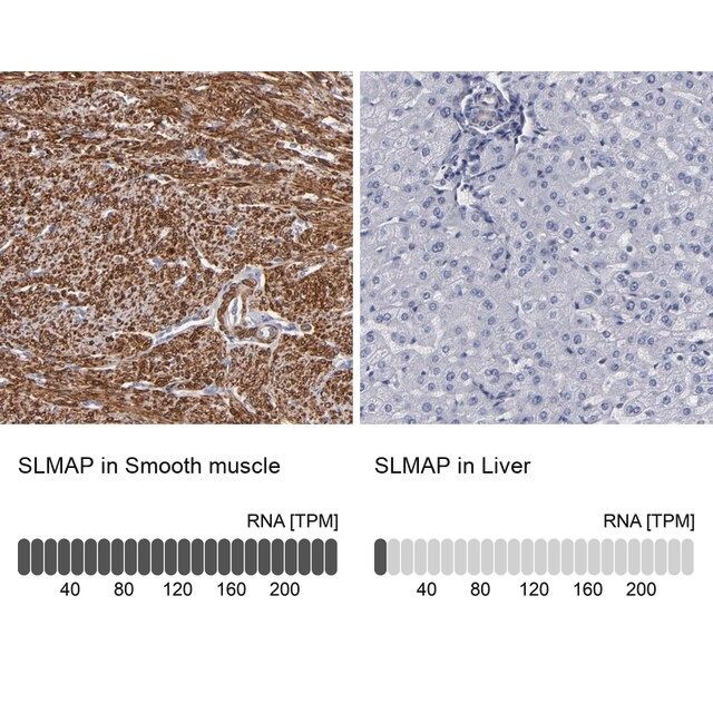 Anti-SLMAP antibody produced in rabbit