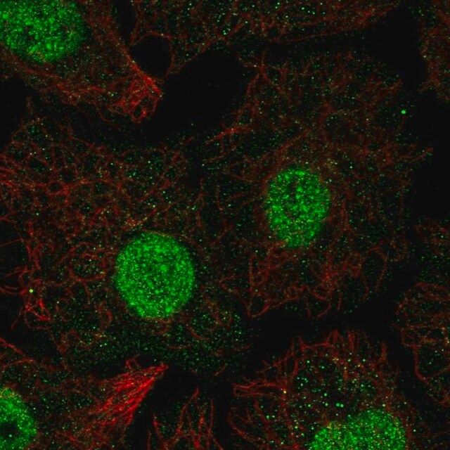 Anti-SMAD6 antibody produced in rabbit