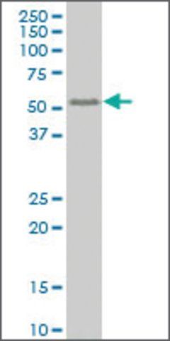 ANTI-SMAD6 antibody produced in mouse