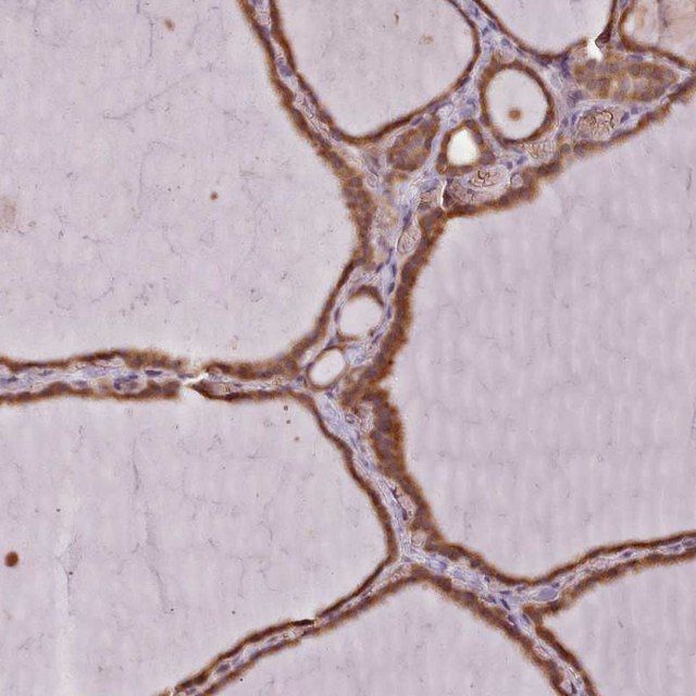 Anti-SLX1A antibody produced in rabbit