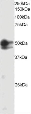 Anti-SMAD2/MADH2 antibody produced in goat