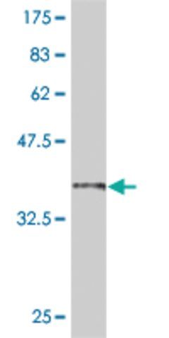 ANTI-SMAD6 antibody produced in mouse