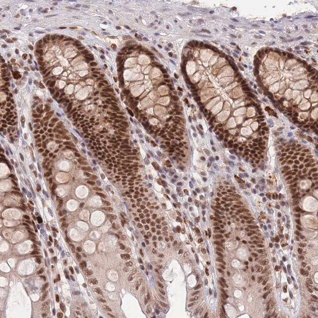 Anti-SMAD9 antibody produced in rabbit