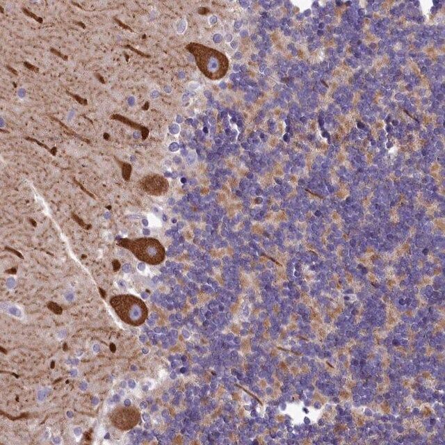 Anti-SMPD4 antibody produced in rabbit