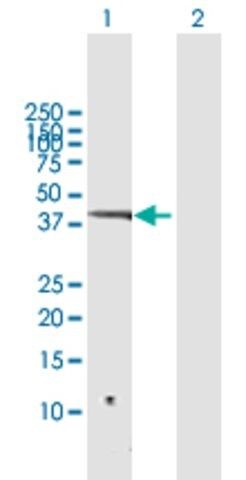 Anti-SNIP1 antibody produced in rabbit