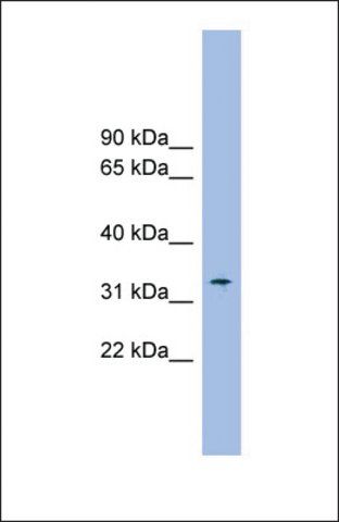 Anti-SLC25A1 antibody produced in rabbit