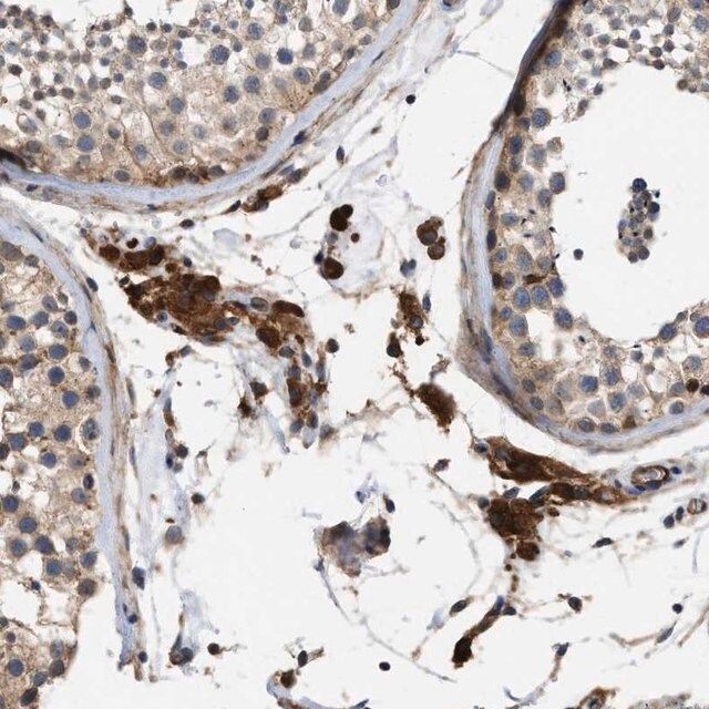 Anti-SLC4A11 antibody produced in rabbit