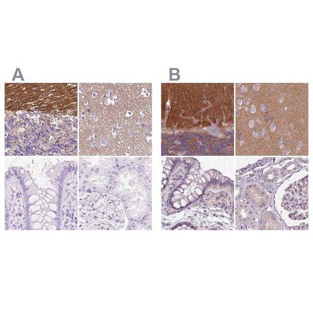 Anti-SLC8A2 antibody produced in rabbit