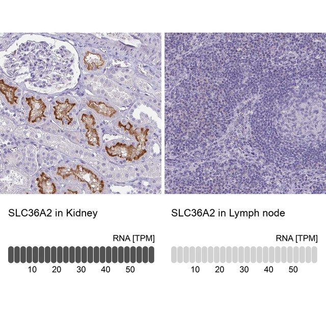 Anti-SLC36A2 antibody produced in rabbit