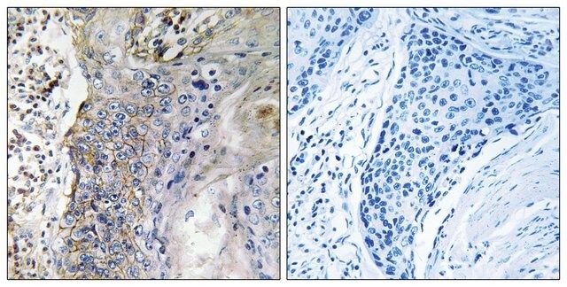 Anti-SLC28A2 antibody produced in rabbit