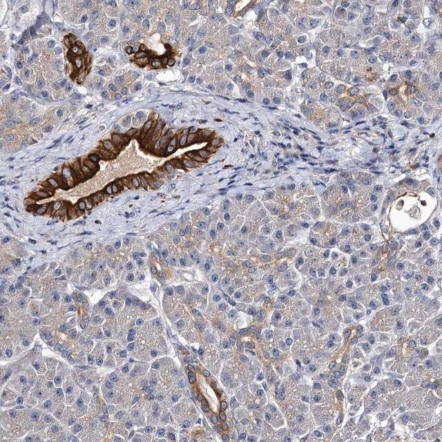 Anti-SLC11A2 antibody produced in rabbit