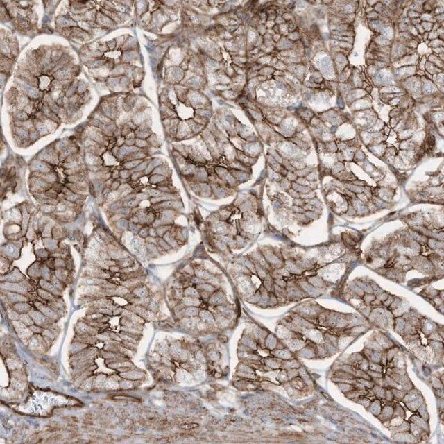 Anti-SLC9A2 antibody produced in rabbit