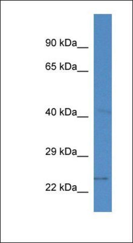 Anti-SLC10A2 antibody produced in rabbit