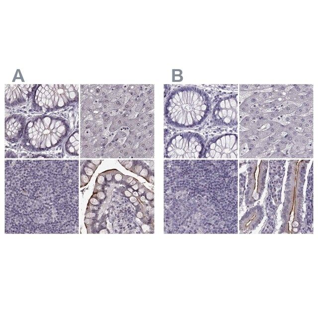 Anti-SLC28A2 antibody produced in rabbit