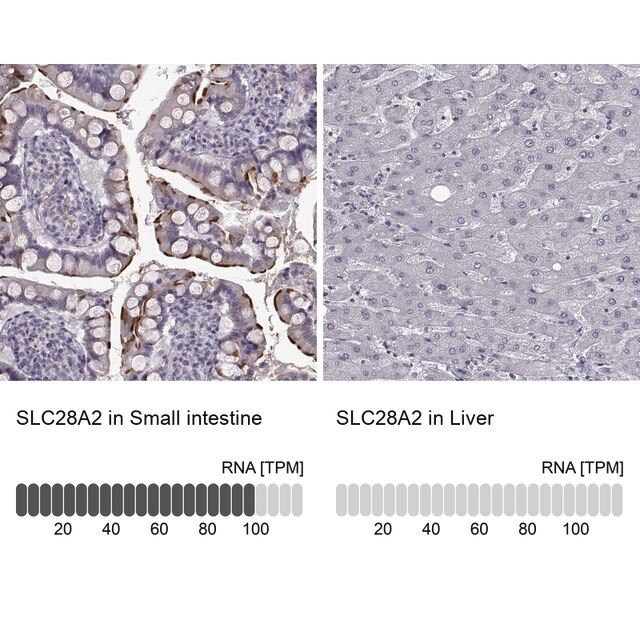 Anti-SLC28A2 antibody produced in rabbit