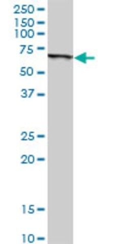 Anti-SLC45A2 antibody produced in rabbit