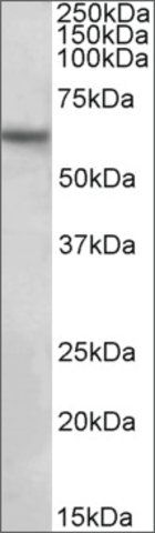 Anti-SLC1A3 (C-terminal) antibody produced in goat