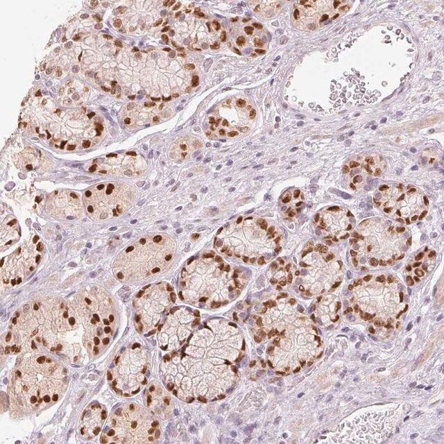 Anti-SLC39A3 antibody produced in rabbit