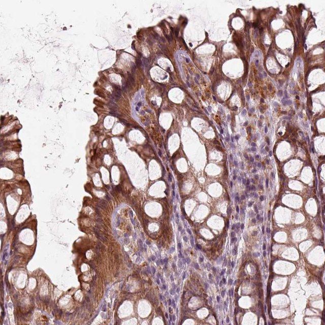 Anti-SLC25A46 antibody produced in rabbit