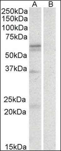 Anti-SLC7A5 antibody produced in goat