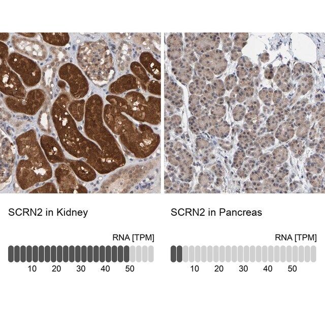 Anti-SCRN2 antibody produced in rabbit