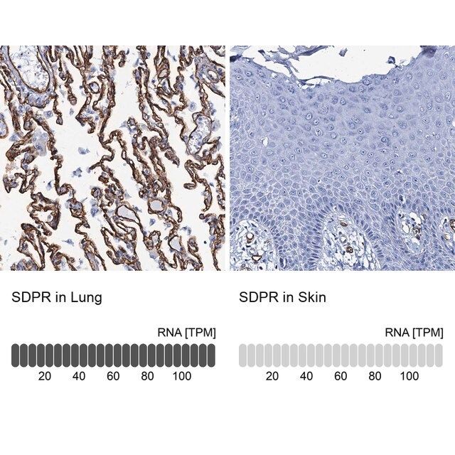 Anti-SDPR antibody produced in rabbit