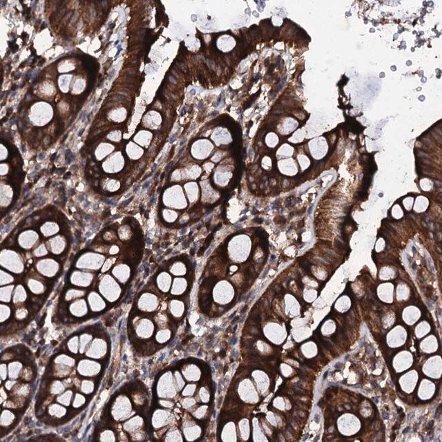 Anti-SDHAF2 antibody produced in rabbit