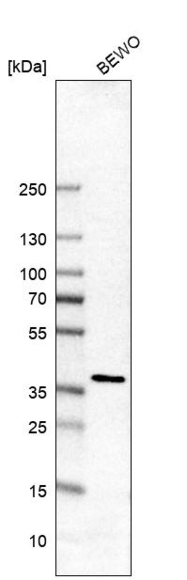 Anti-SEC13 antibody produced in rabbit