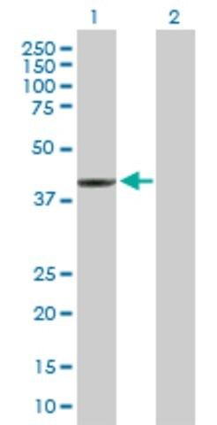 Anti-SERPINB3 antibody produced in mouse