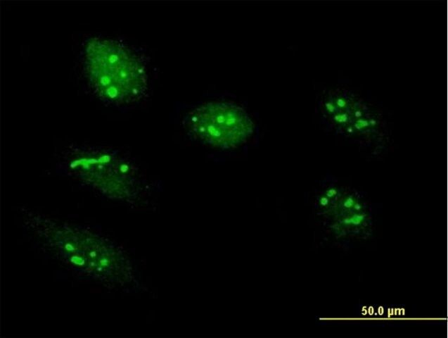 Anti-RRS1 antibody produced in mouse