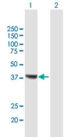 Anti-RSAD2 antibody produced in mouse