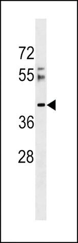 ANTI-RSRC2(N-TERMINAL) antibody produced in rabbit