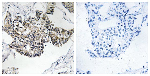 Anti-RSAD1 antibody produced in rabbit