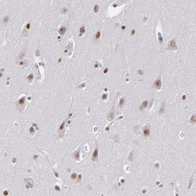 Anti-RRP7A antibody produced in rabbit