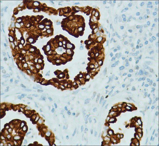 Anti-RRM1 antibody, Rabbit monoclonal