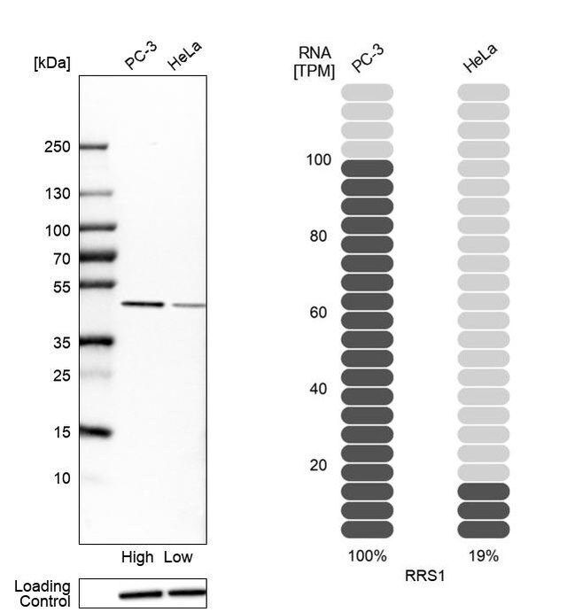 Anti-RRS1 antibody produced in rabbit