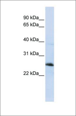 Anti-RTN1 (ab1) antibody produced in rabbit