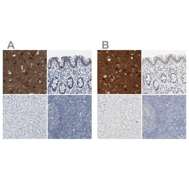 Anti-RTN3 antibody produced in rabbit