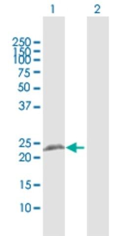 Anti-RTN3 antibody produced in rabbit