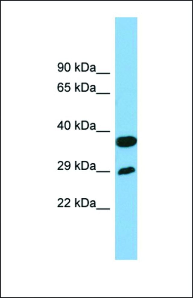 Anti-RTP4 antibody produced in rabbit