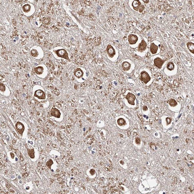 Anti-RSC1A1 antibody produced in rabbit