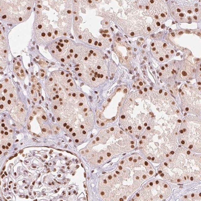 Anti-RTP4 antibody produced in rabbit