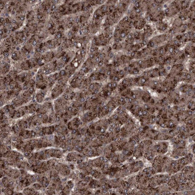 Anti-RSU1 antibody produced in rabbit