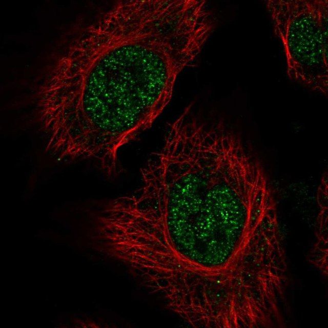 Anti-RSRP1 antibody produced in rabbit