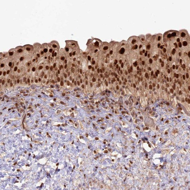 Anti-RRP8 antibody produced in rabbit