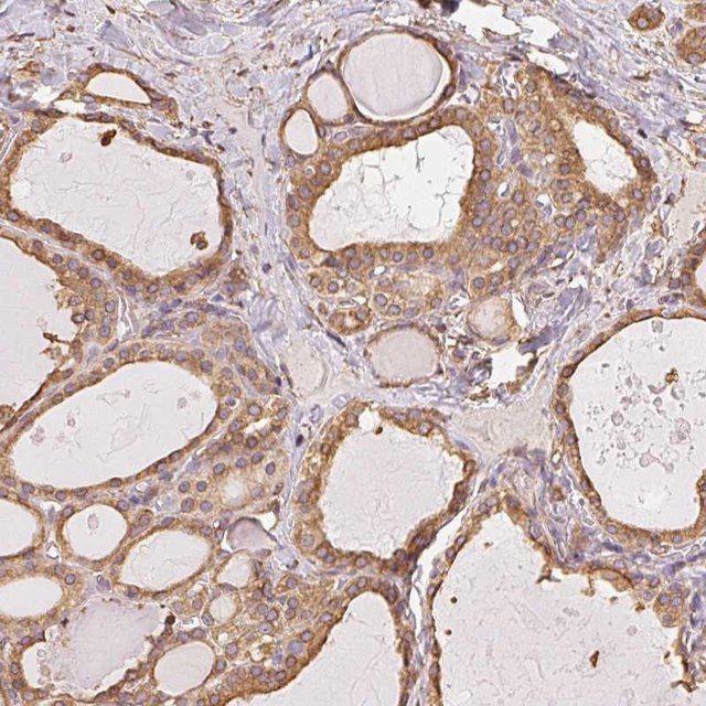 Anti-RSBN1 antibody produced in rabbit