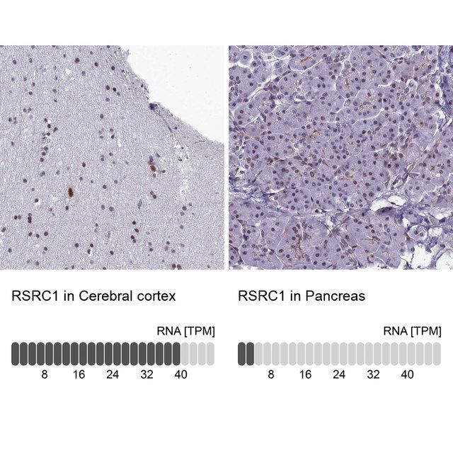 Anti-RSRC1 antibody produced in rabbit