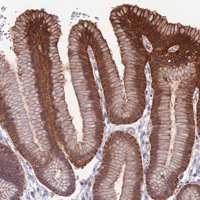 Anti-RTN4RL1 antibody produced in rabbit